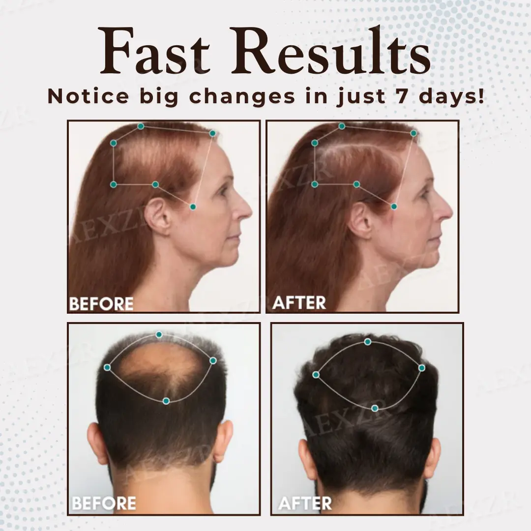 Hair Regrowth Capsules Revive Follicles, Boost Hair Volume - Image 2