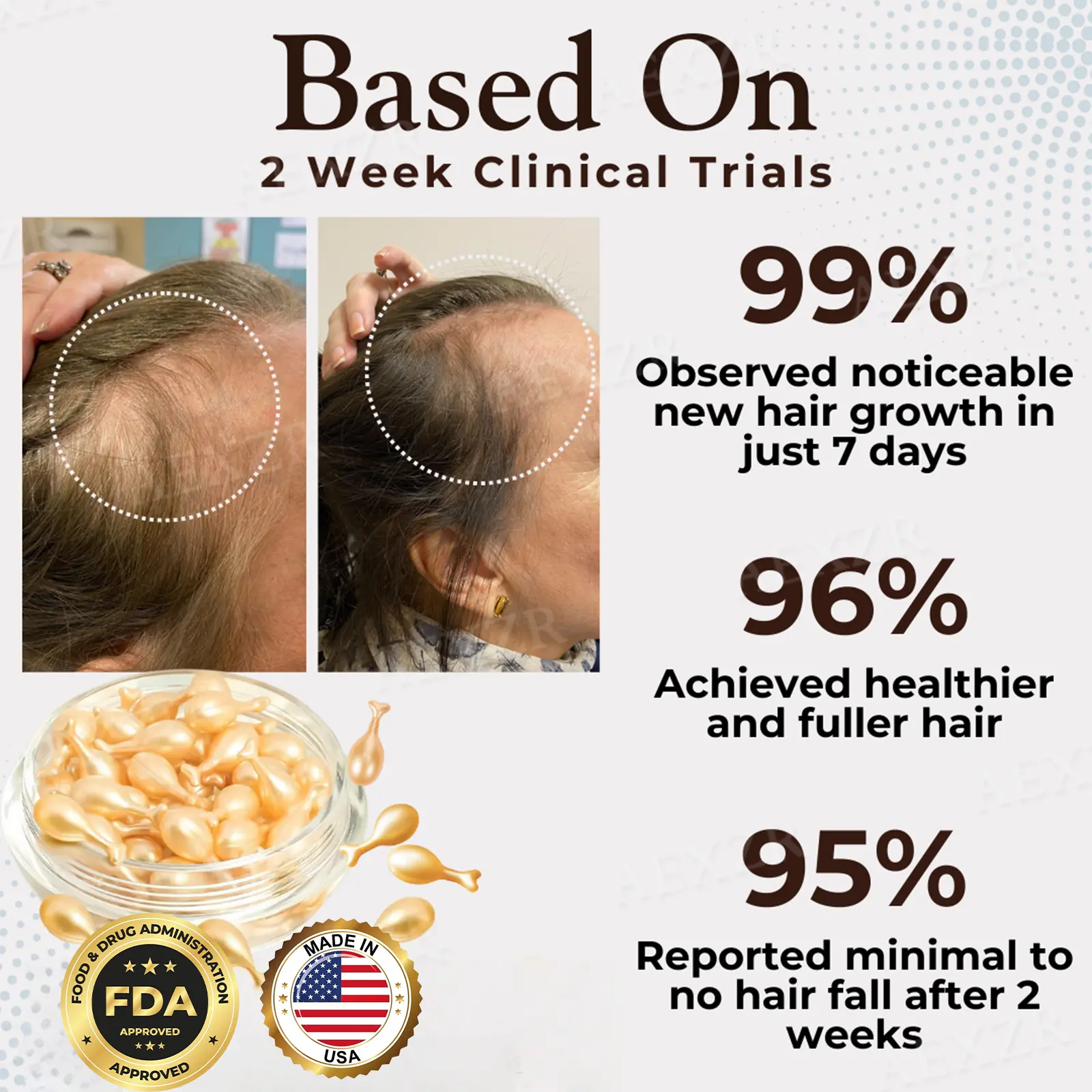 Hair Regrowth Capsules Revive Follicles, Boost Hair Volume - Image 3