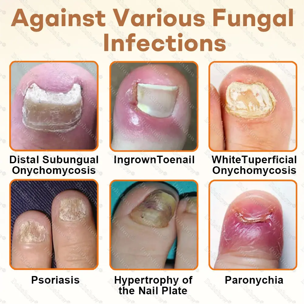 NailRescue BeeVenom Renewal Spray - Image 3