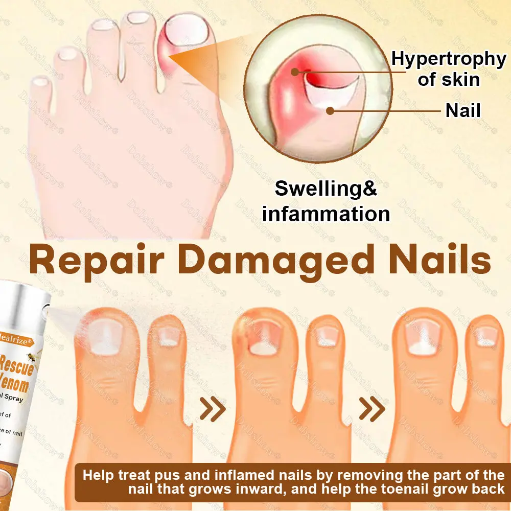 NailRescue BeeVenom Renewal Spray - Image 5