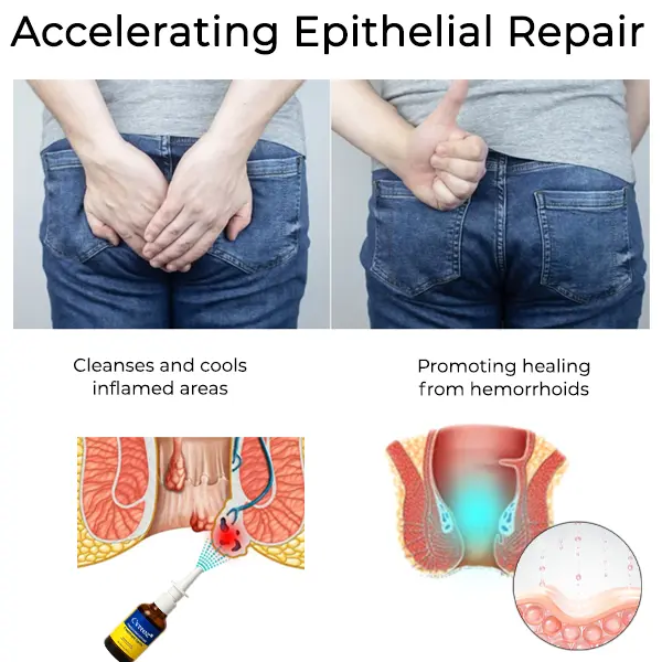 MAX Herbal Hemorrhoid Treatment Anal Spray - Image 4