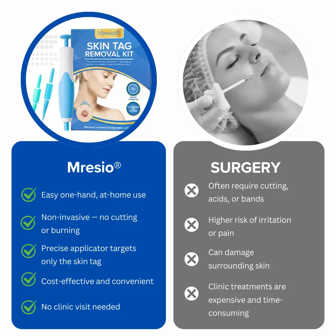 Skin Tag Removal Kit - Image 7