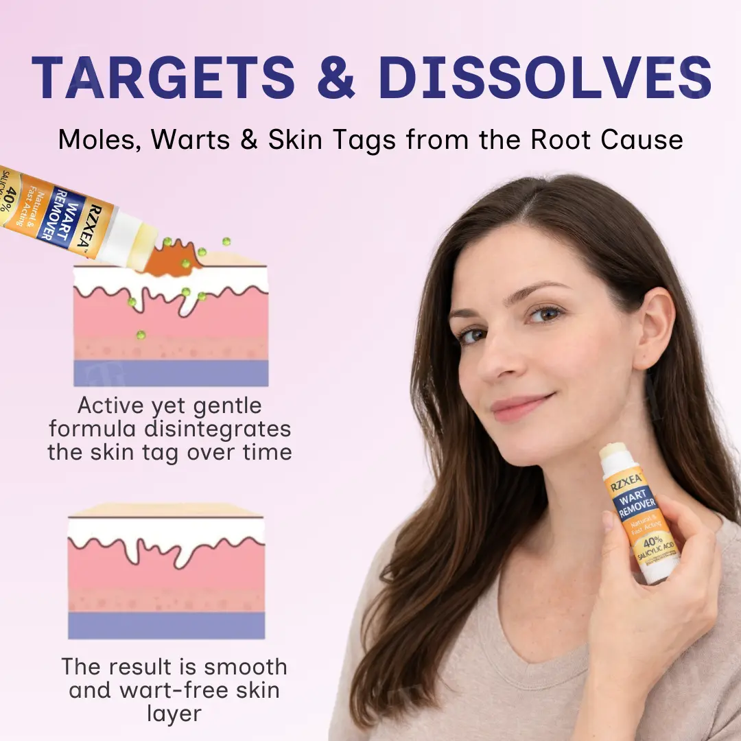Solid-Stick Wart Remover, Skin Tags in Just 48 Hours - Image 4