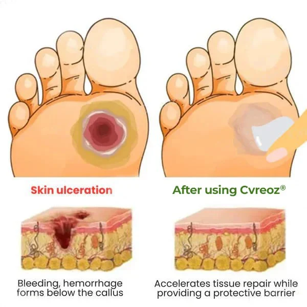Diabetic's Foot Cream - Image 4
