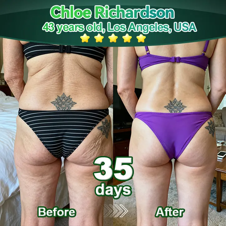 ๐๐ก๐๐ ๐ถ๐๐๐ & ๐ถ๐๐๐๐๐๐๐ ๐๐๐๐ก๐๐๐ ๐๐๐๐ ๐ท๐๐๐๐ - Image 4