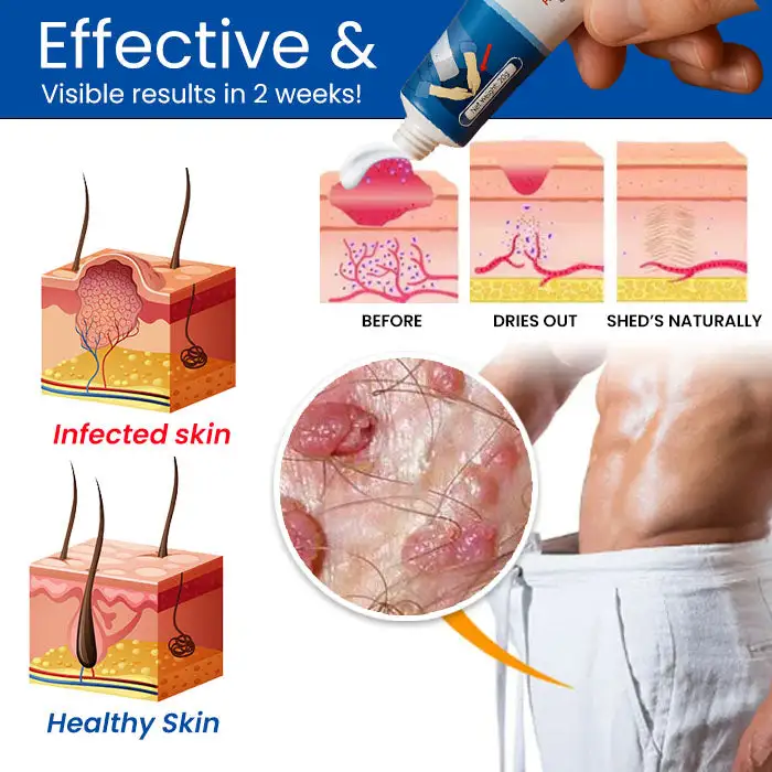 GentX Relief Cream - Image 2