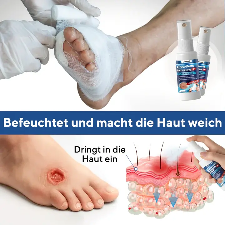 GlucoDerm Barrierespray - Image 7
