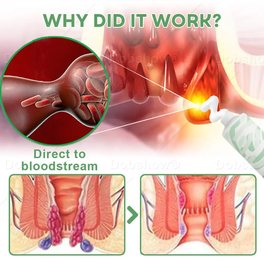 Hemorrhoid Soothing Cream - Image 5