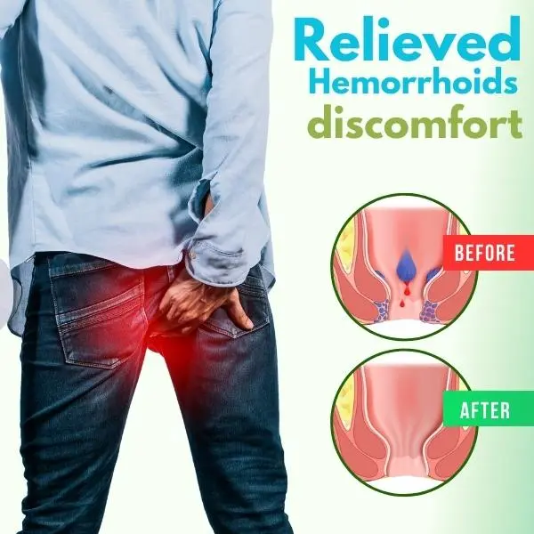 Herbal Hemorrhoid Spray - Image 3