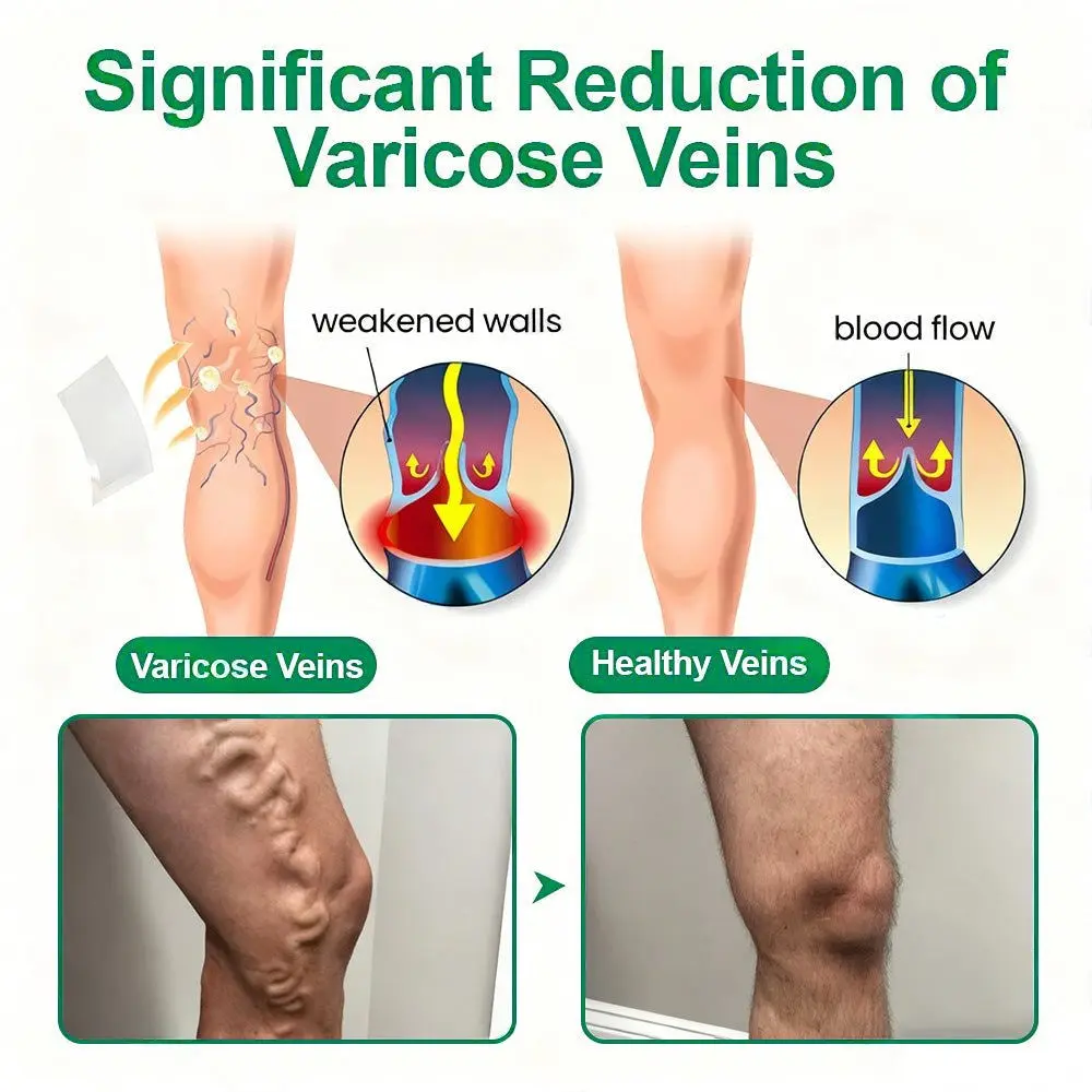 VeinTarget Microneedle Patch Once Daily, Visible Results in 7 Days - Image 3