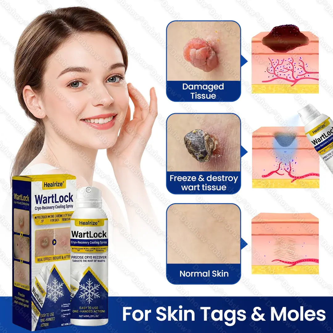 WartLock Cryo-Recovery Cooling Spray - Image 6