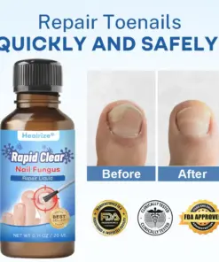 Nano Rapid Clear Nail Fungus Rapair Liquid Effective in Seven Days, Permanently Eliminates the Root