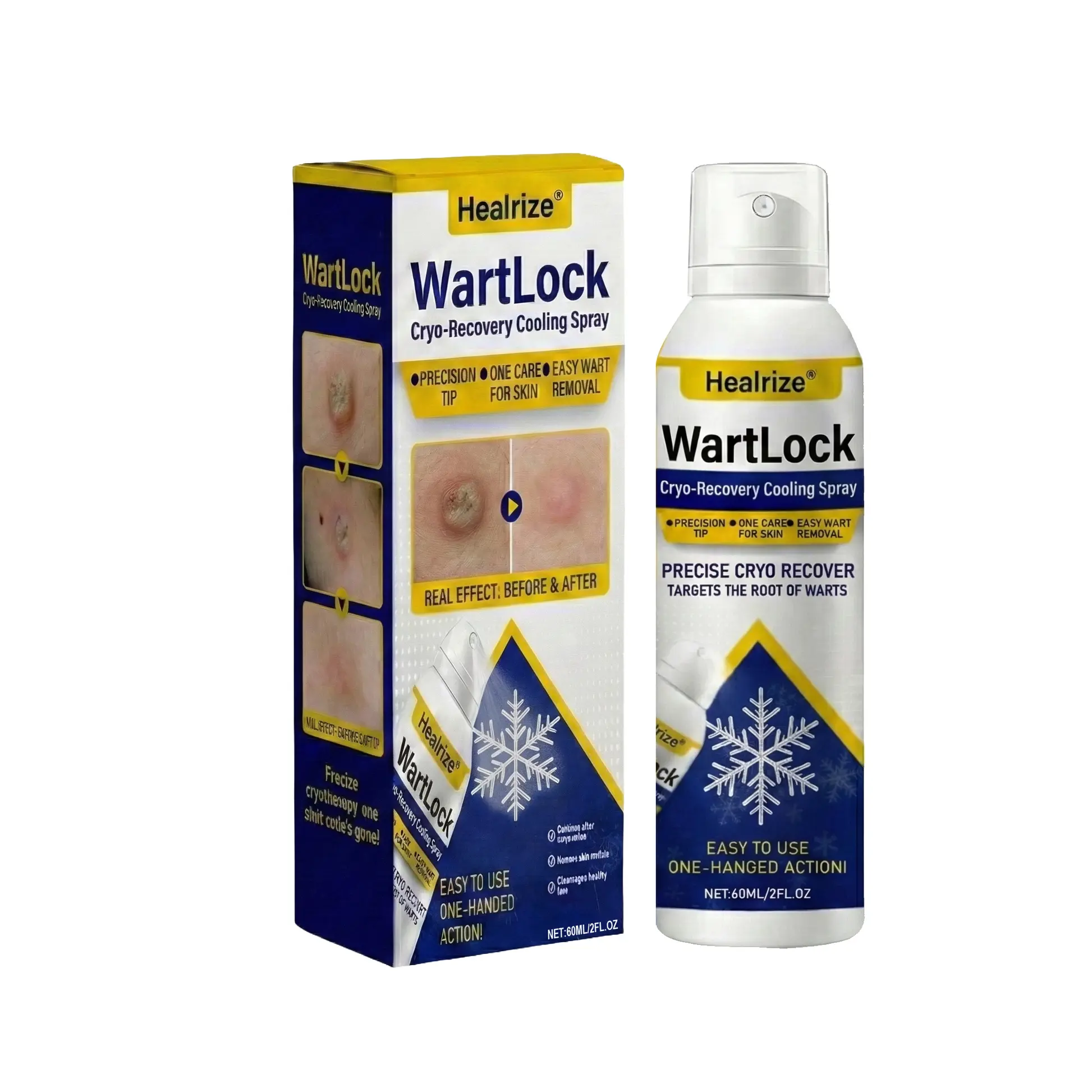 WartLock Cryo-Recovery Cooling Spray