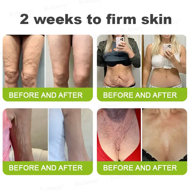 Botox Vita-A Retinol Wrinkle-Lift Cream Made Shipped from CA - Image 8