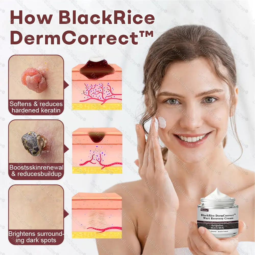 BlackRice Wart Recovery Cream Suitable for all skin types - Image 2