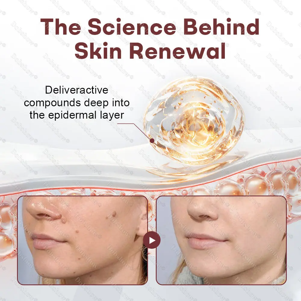 BlackRice Wart Recovery Cream Suitable for all skin types - Image 4