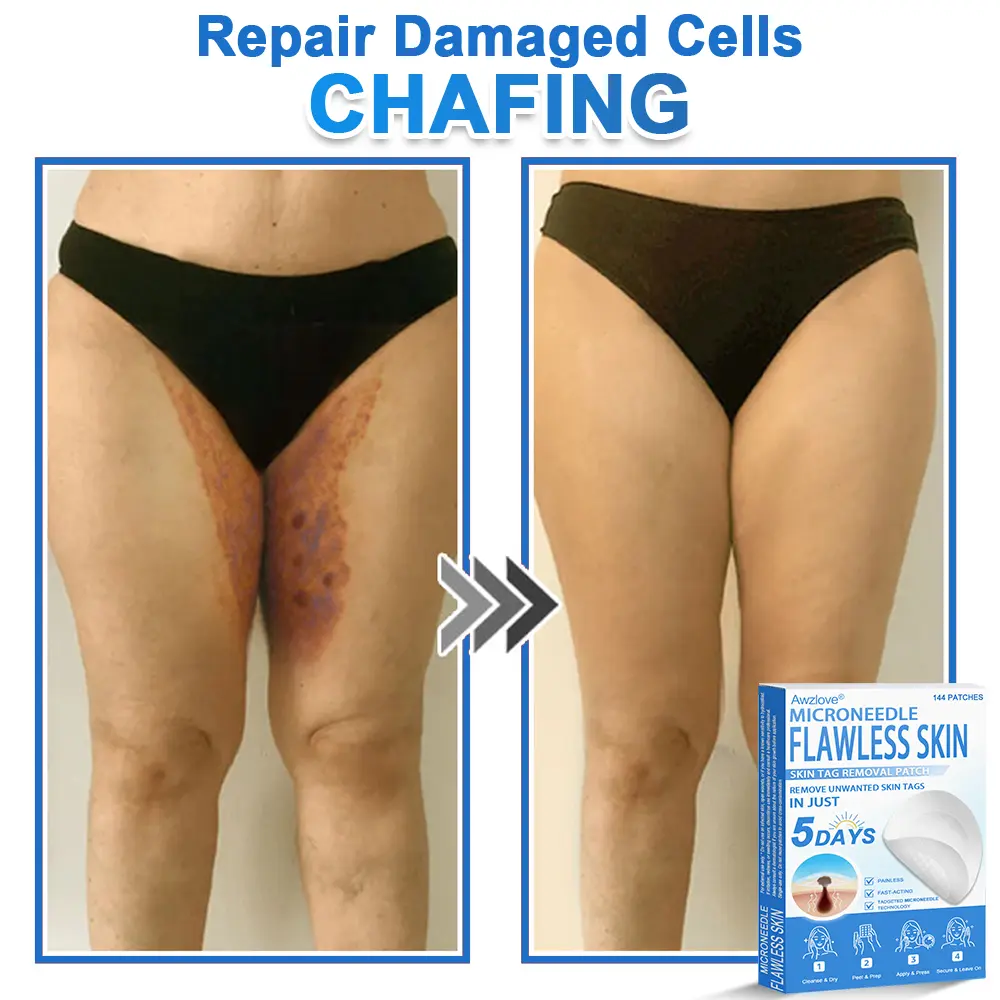 2-in-1 Microneedle & Hydrocolloid Patch - Image 5
