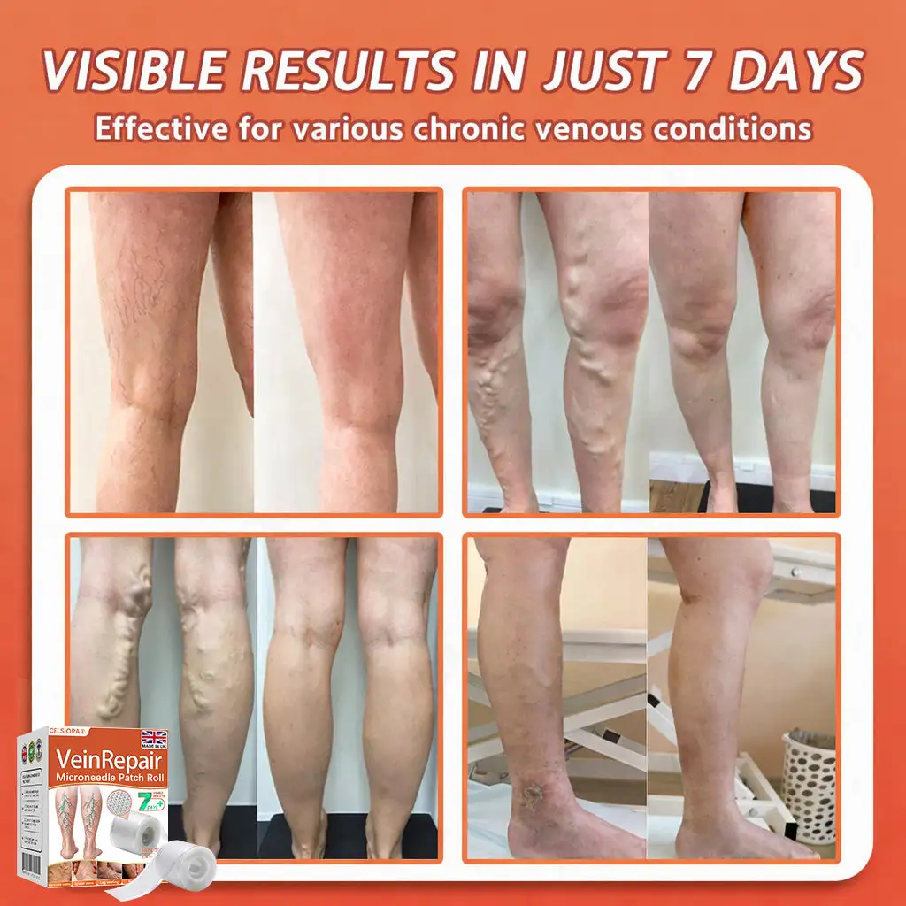 Vein Ease Microneedle Care Patch - Image 3