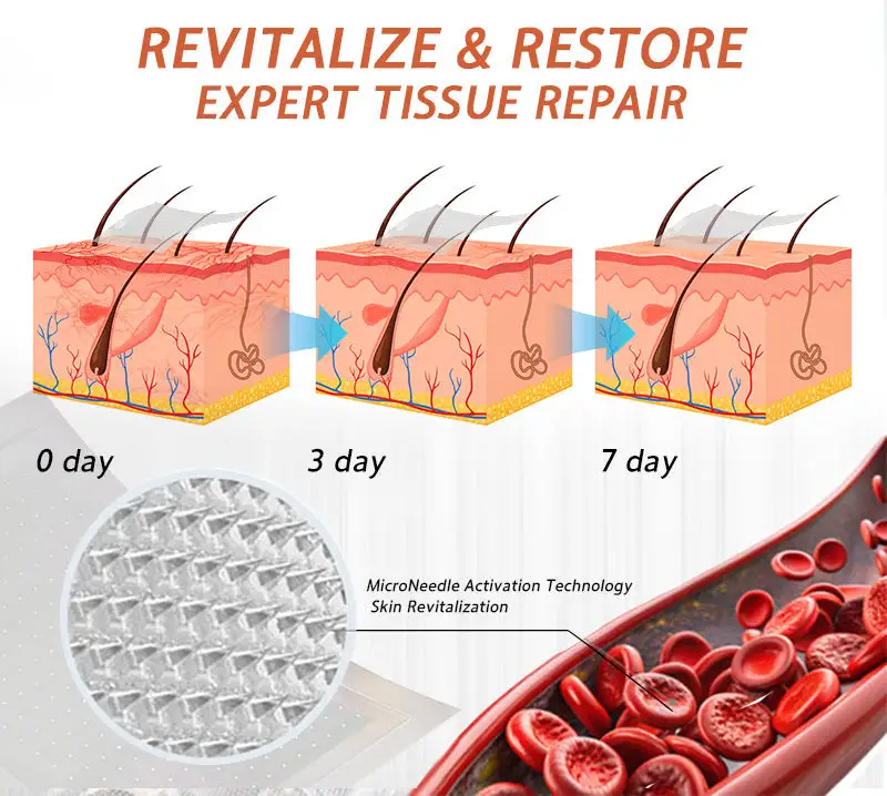 Vein Ease Microneedle Care Patch - Image 8