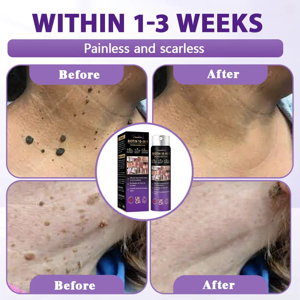 Biotin 10-in-1 Skin Restoration Spray - Image 10