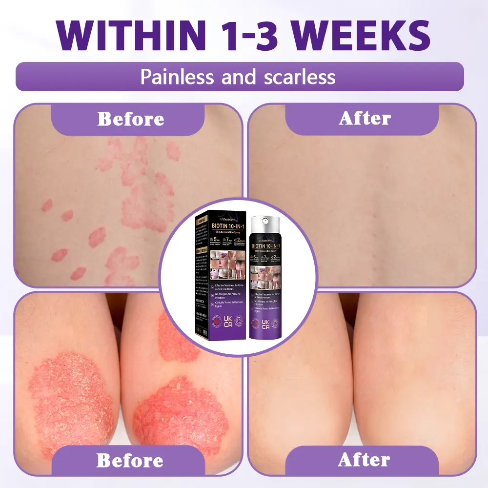 Biotin 10-in-1 Skin Restoration Spray - Image 11