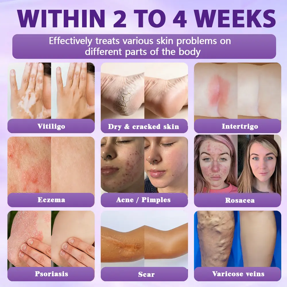 Biotin 10-in-1 Skin Restoration Spray - Image 2