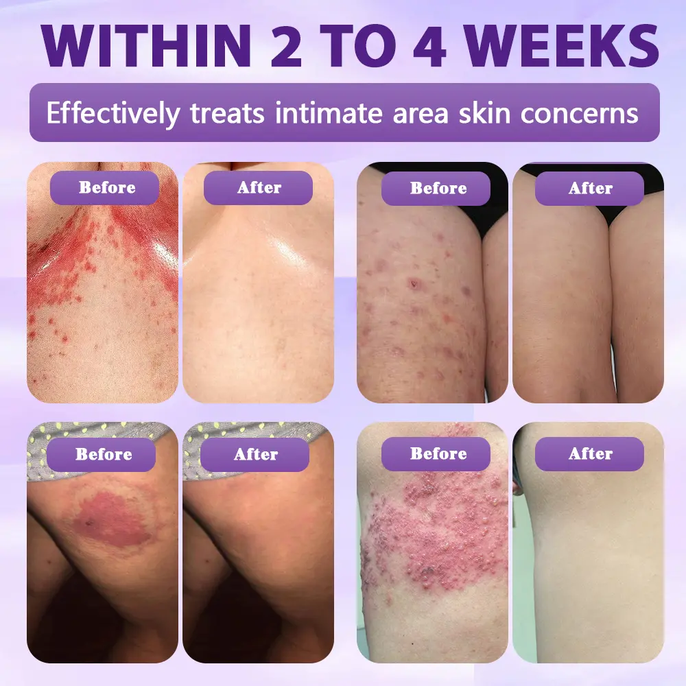 Biotin 10-in-1 Skin Restoration Spray - Image 4