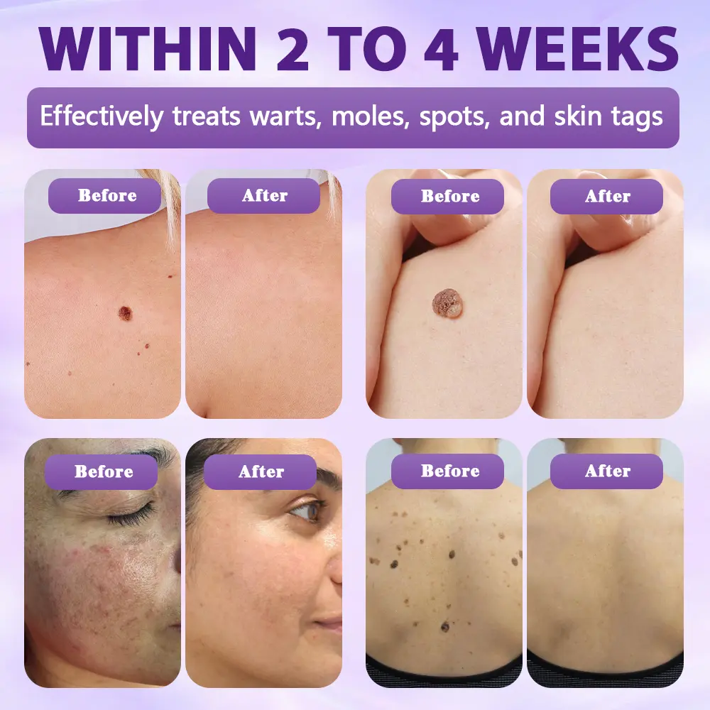 Biotin 10-in-1 Skin Restoration Spray - Image 5