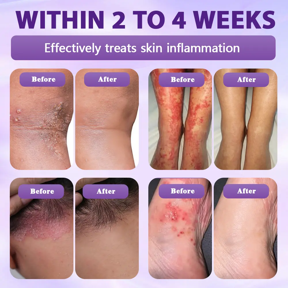 Biotin 10-in-1 Skin Restoration Spray - Image 6