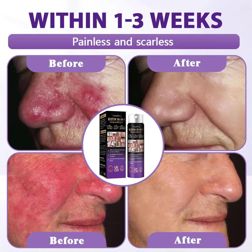 Biotin 10-in-1 Skin Restoration Spray - Image 8