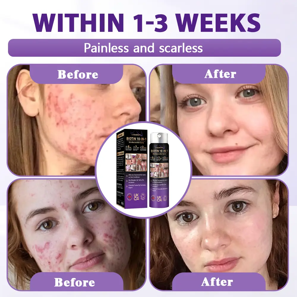 Biotin 10-in-1 Skin Restoration Spray - Image 9