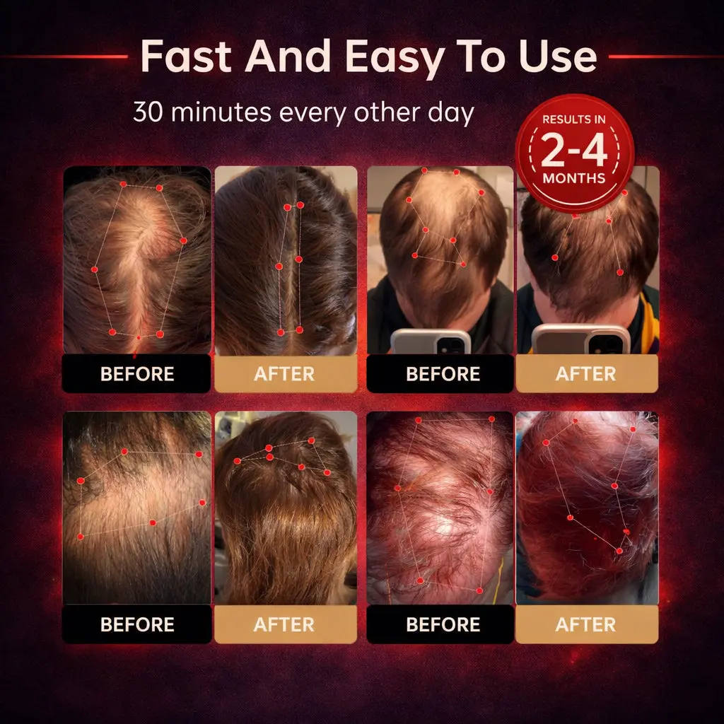 Red Light Cap — Regrow Hair, Reduce Shedding - Image 6