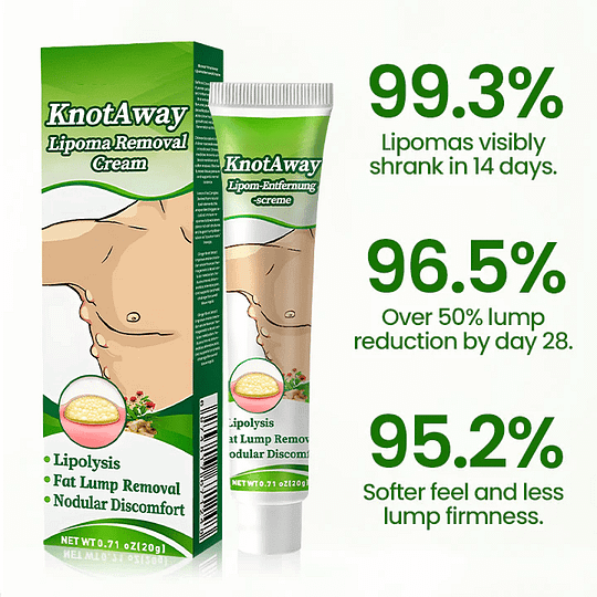 KnotAway Lipoma Removal Cream - Image 3