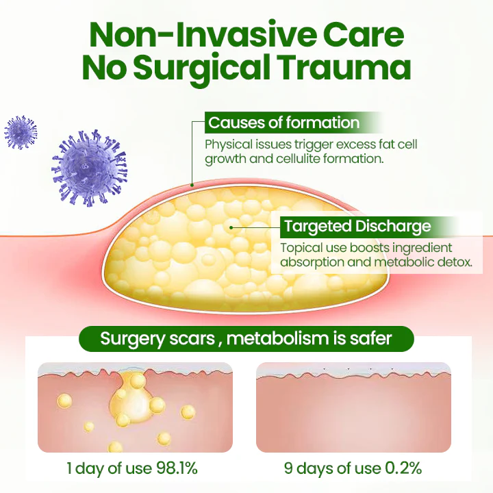 KnotAway Lipoma Removal Cream - Image 4