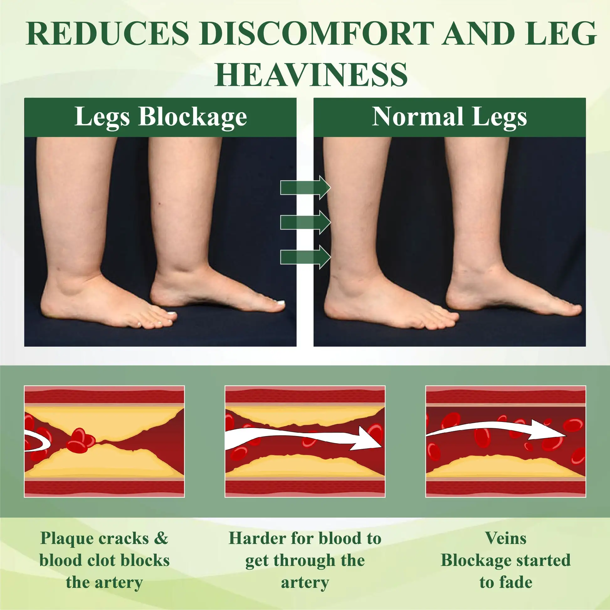 FluidEase Leg Therapy Edema Cream - Image 5