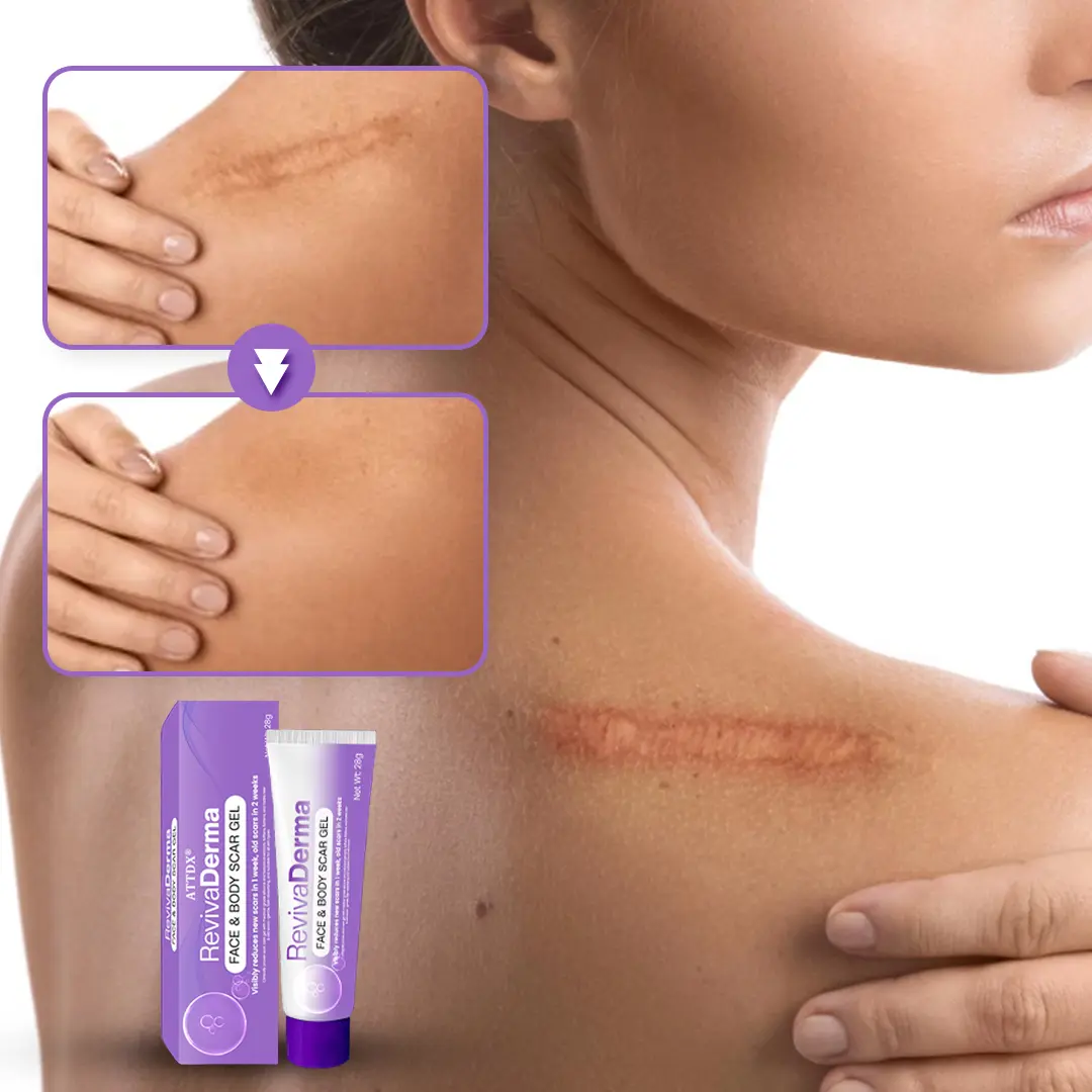 RevivaDerma Face & Body Scar Gel - Image 3