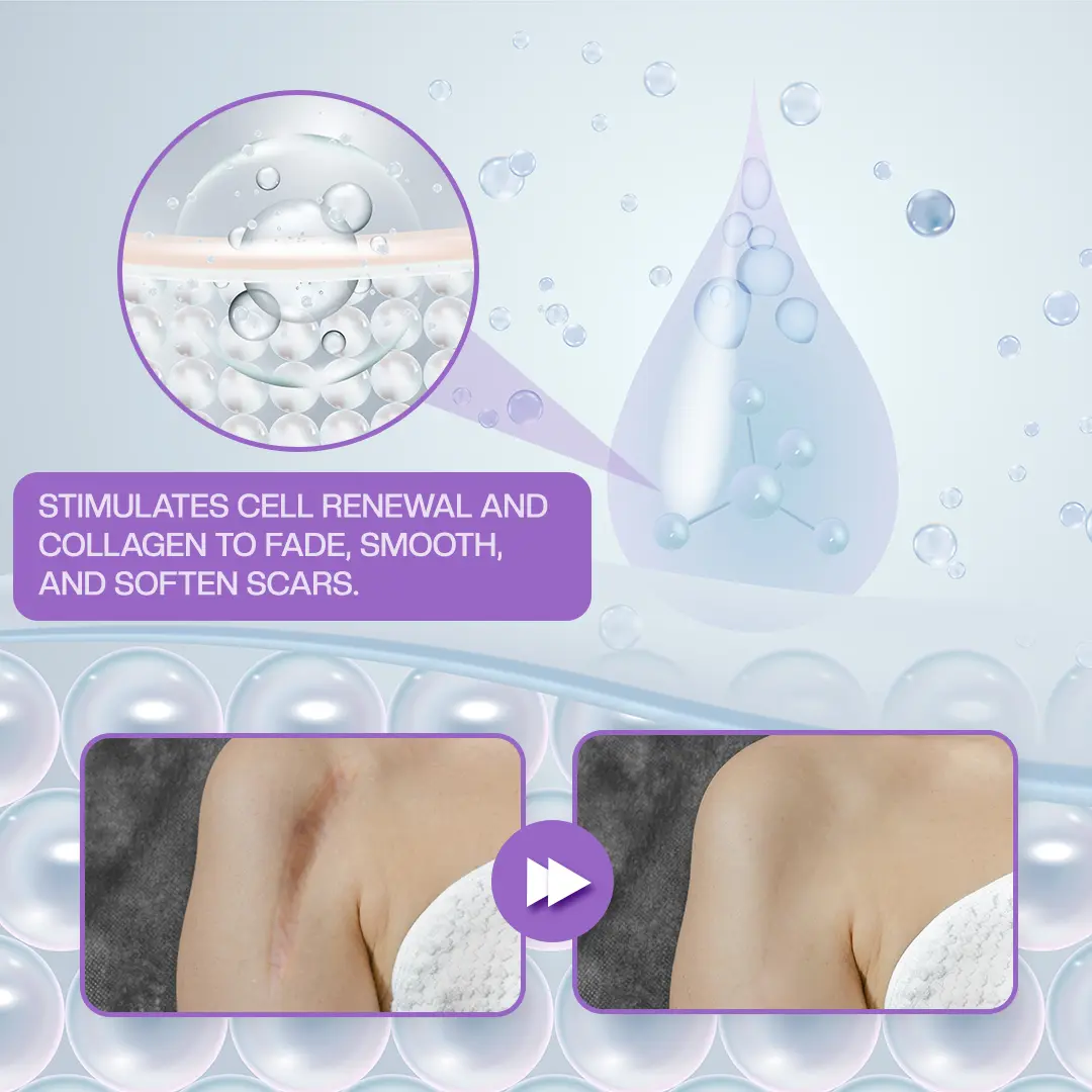 RevivaDerma Face & Body Scar Gel - Image 6