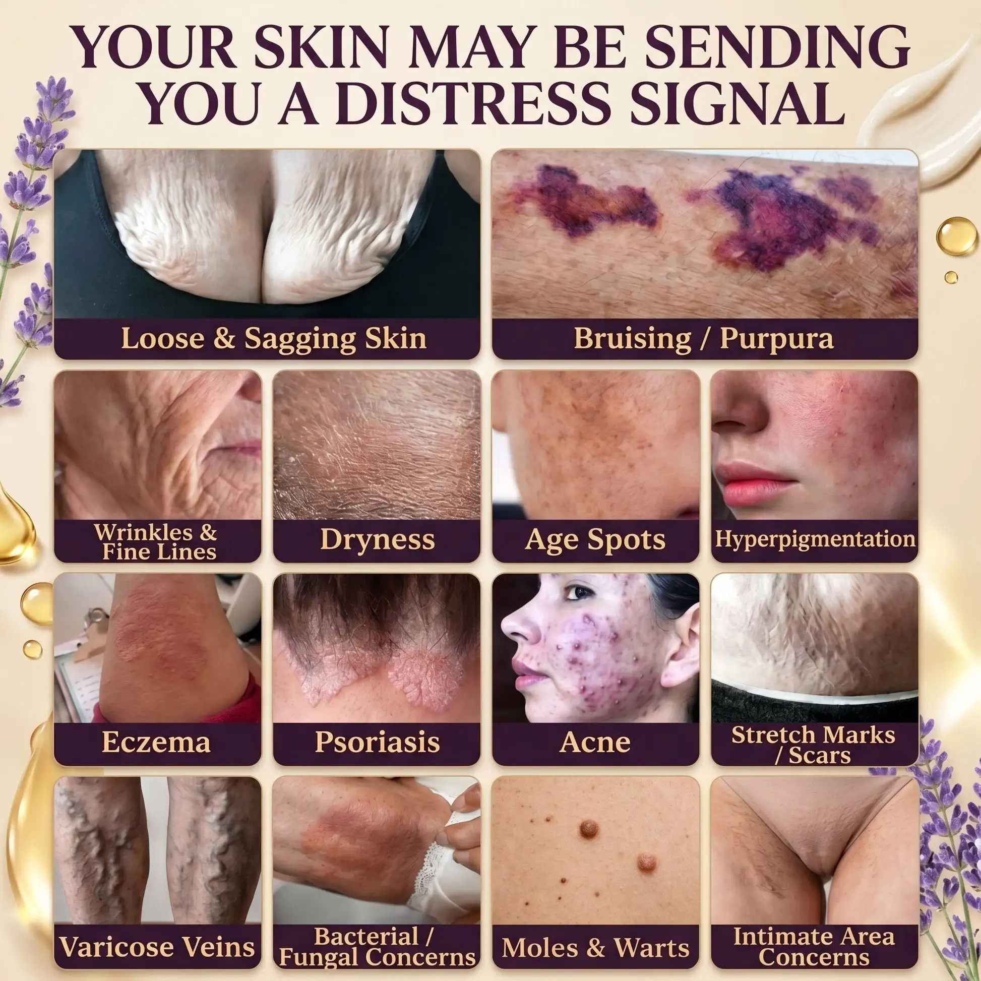 Anniecare 10-in-1 Skin Restoration Cream - Image 2