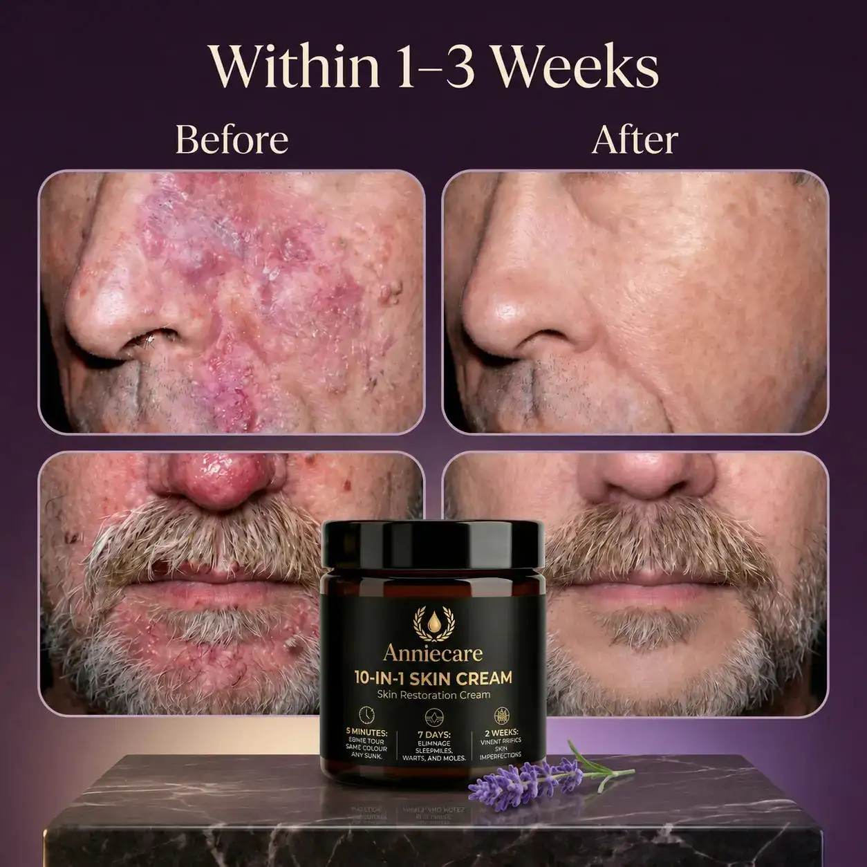 Anniecare 10-in-1 Skin Restoration Cream - Image 3