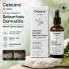 Seborrheic Dermatitis Relief Derm Serum