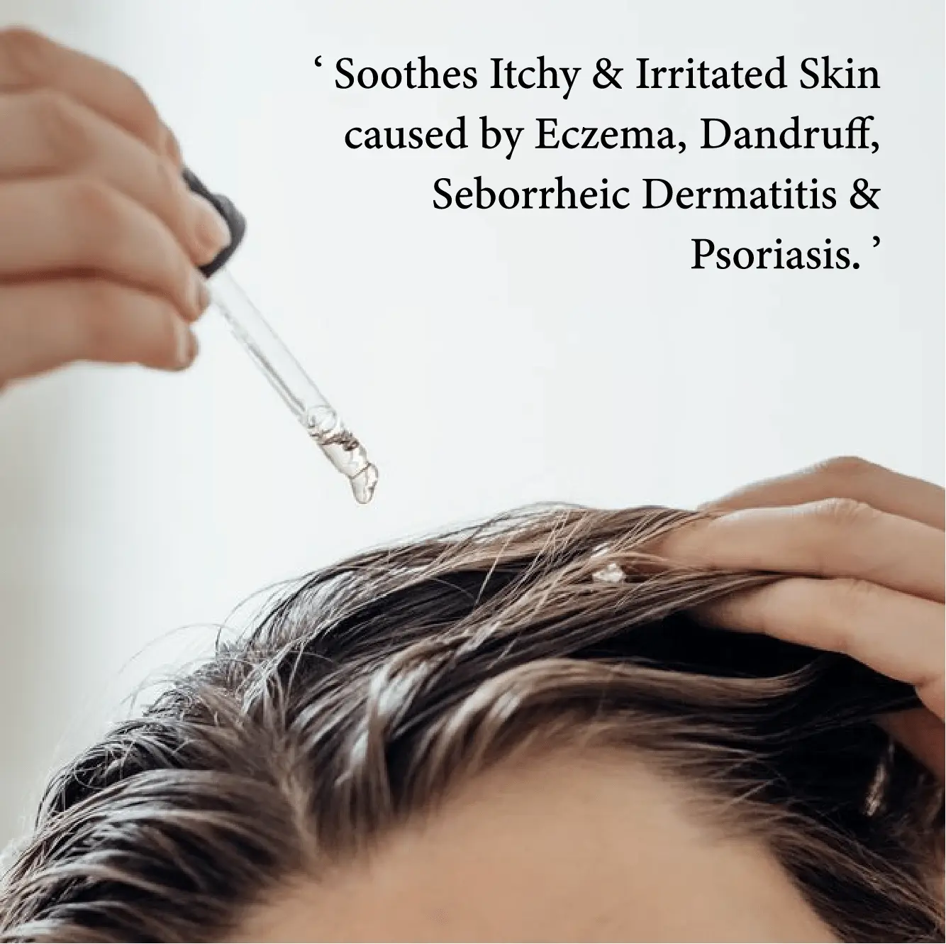 Seborrheic Dermatitis Relief Derm Serum - Image 5