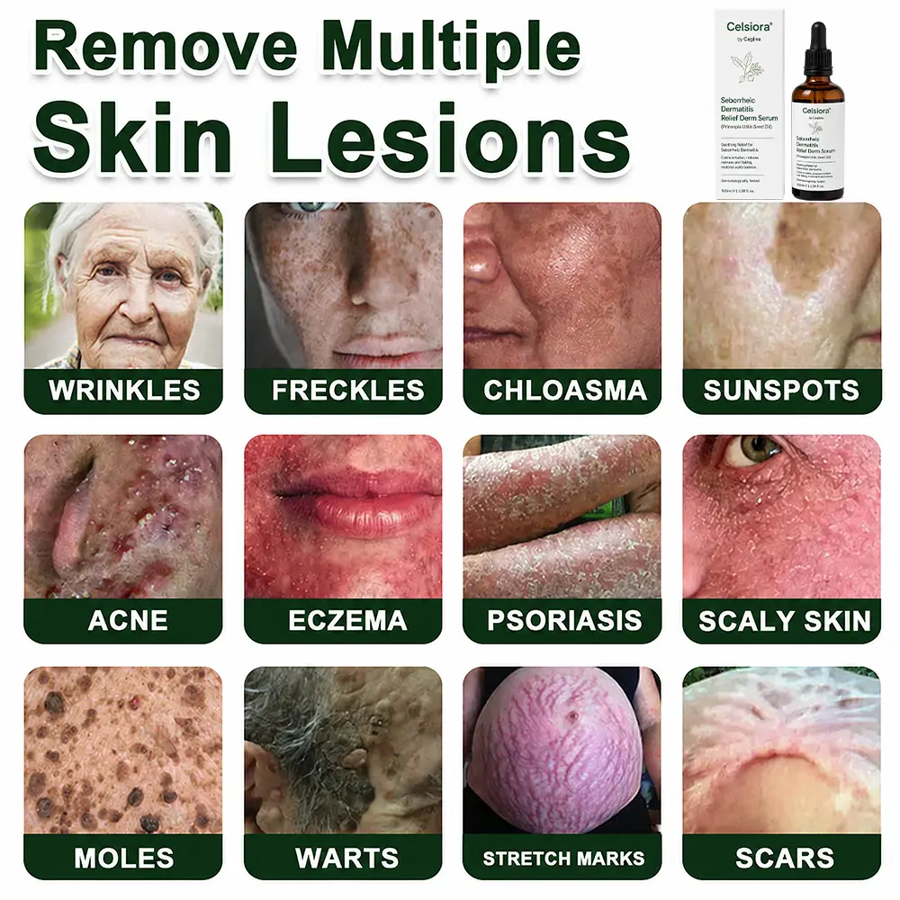 Seborrheic Dermatitis Relief Derm Serum - Image 9
