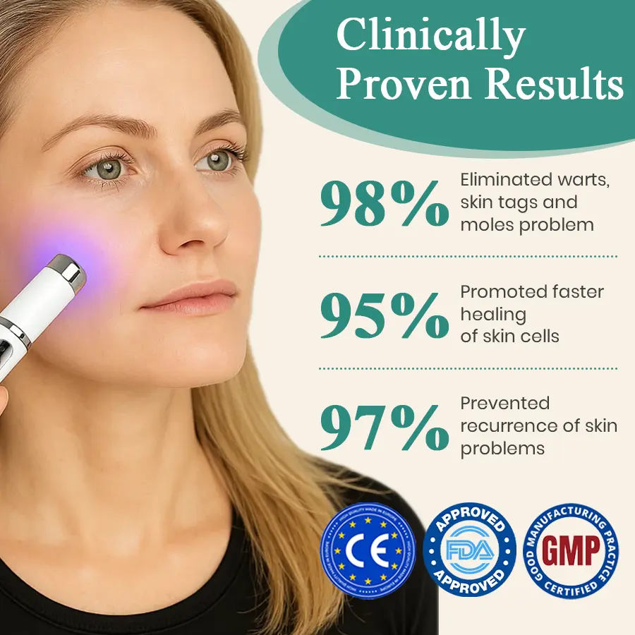 LumeSkin Mole and Wart Instant Removal Laser Pen ACE 6 - Image 3