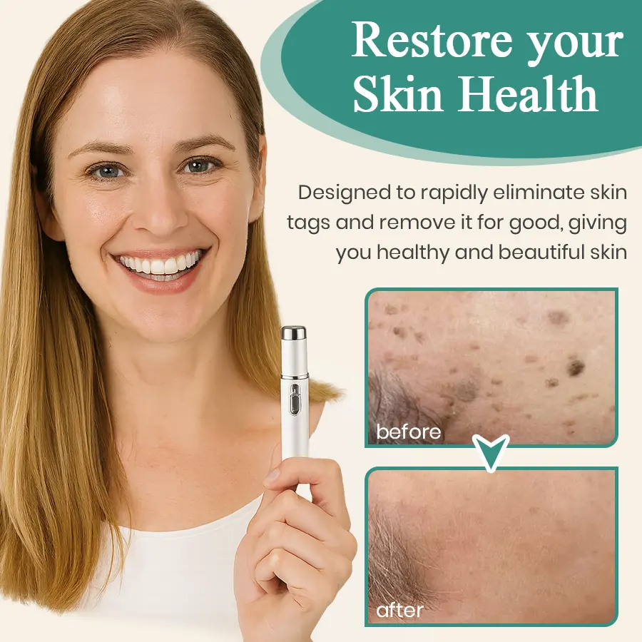 LumeSkin Mole and Wart Instant Removal Laser Pen ACE 6 - Image 6