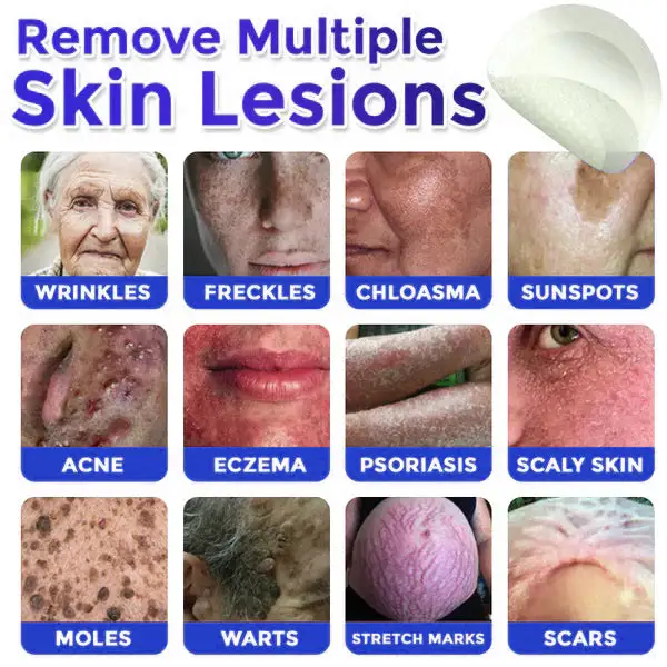 MicroNeedle Botanic Skin Tag Removal Patch - Image 2