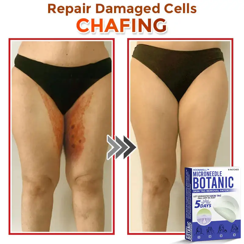 MicroNeedle Botanic Skin Tag Removal Patch - Image 3