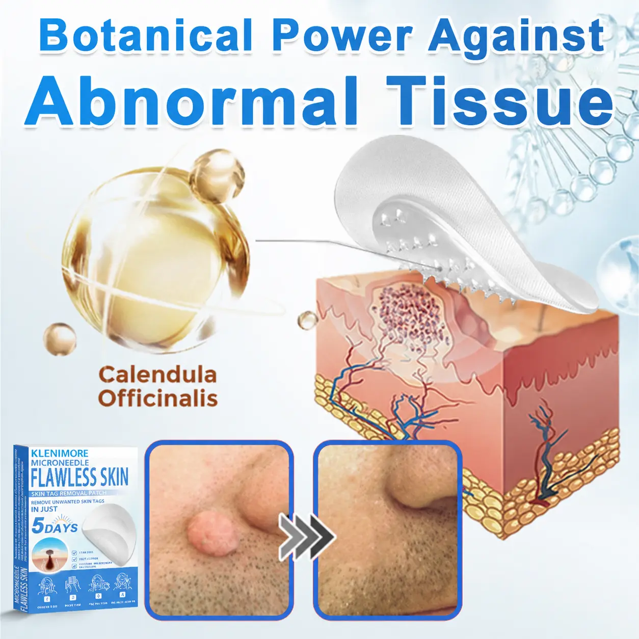 2-in-1 Hydrocolloid Pimple Patches - Image 12