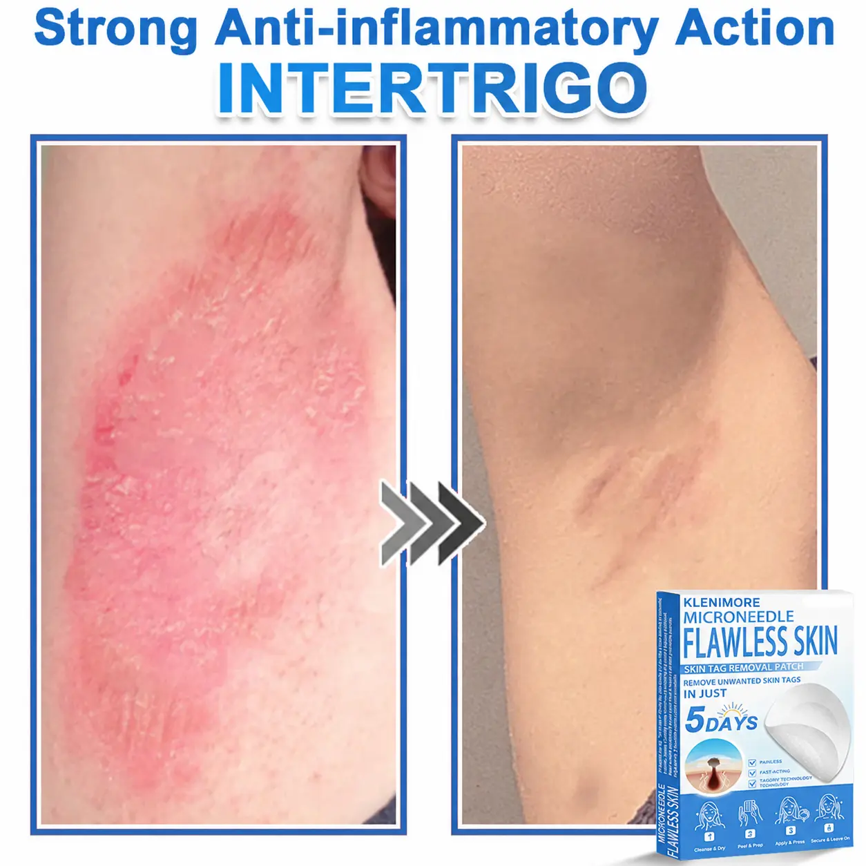 2-in-1 Hydrocolloid Pimple Patches - Image 6