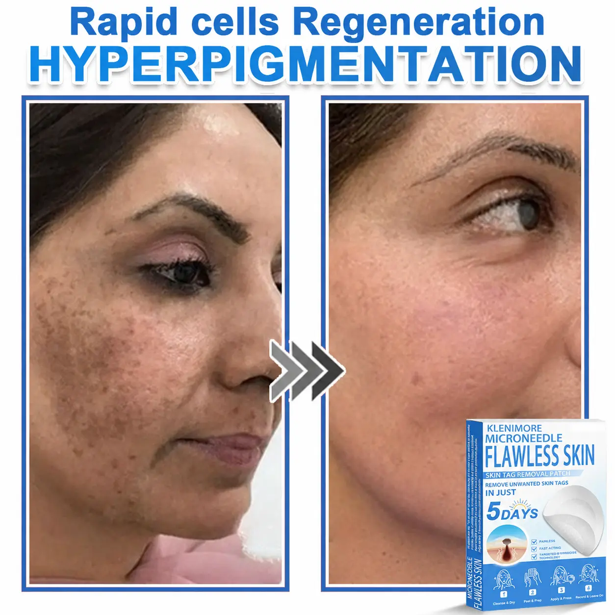 2-in-1 Hydrocolloid Pimple Patches - Image 7