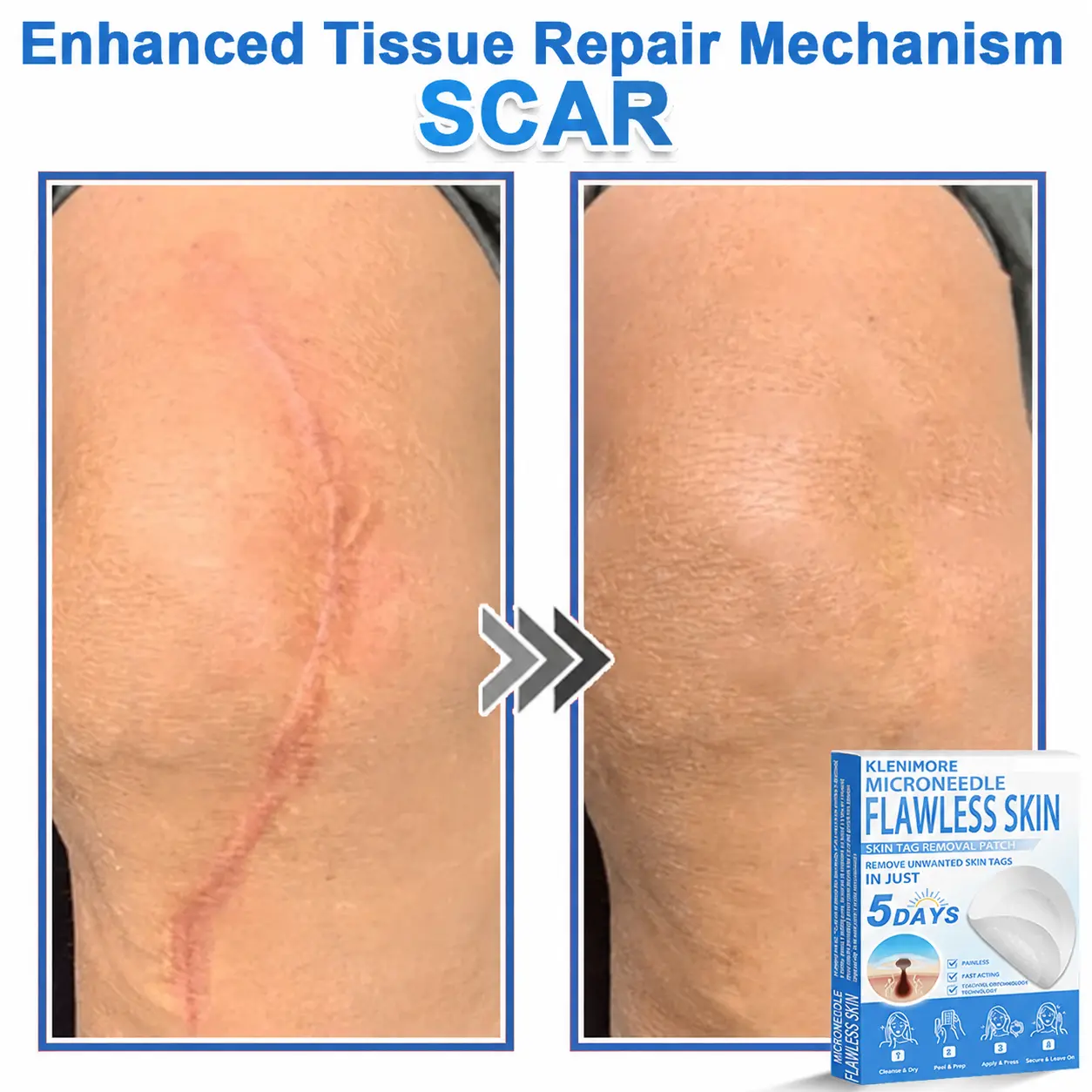 2-in-1 Hydrocolloid Pimple Patches - Image 9